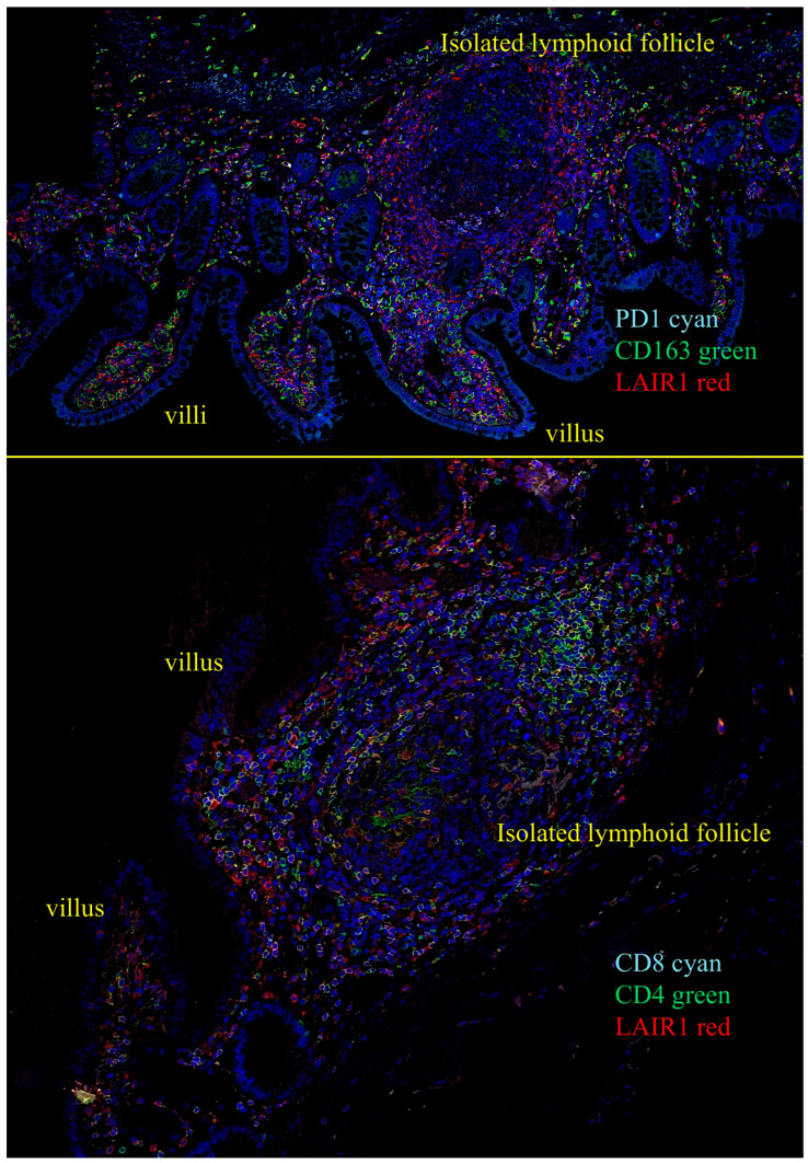 Figure 11