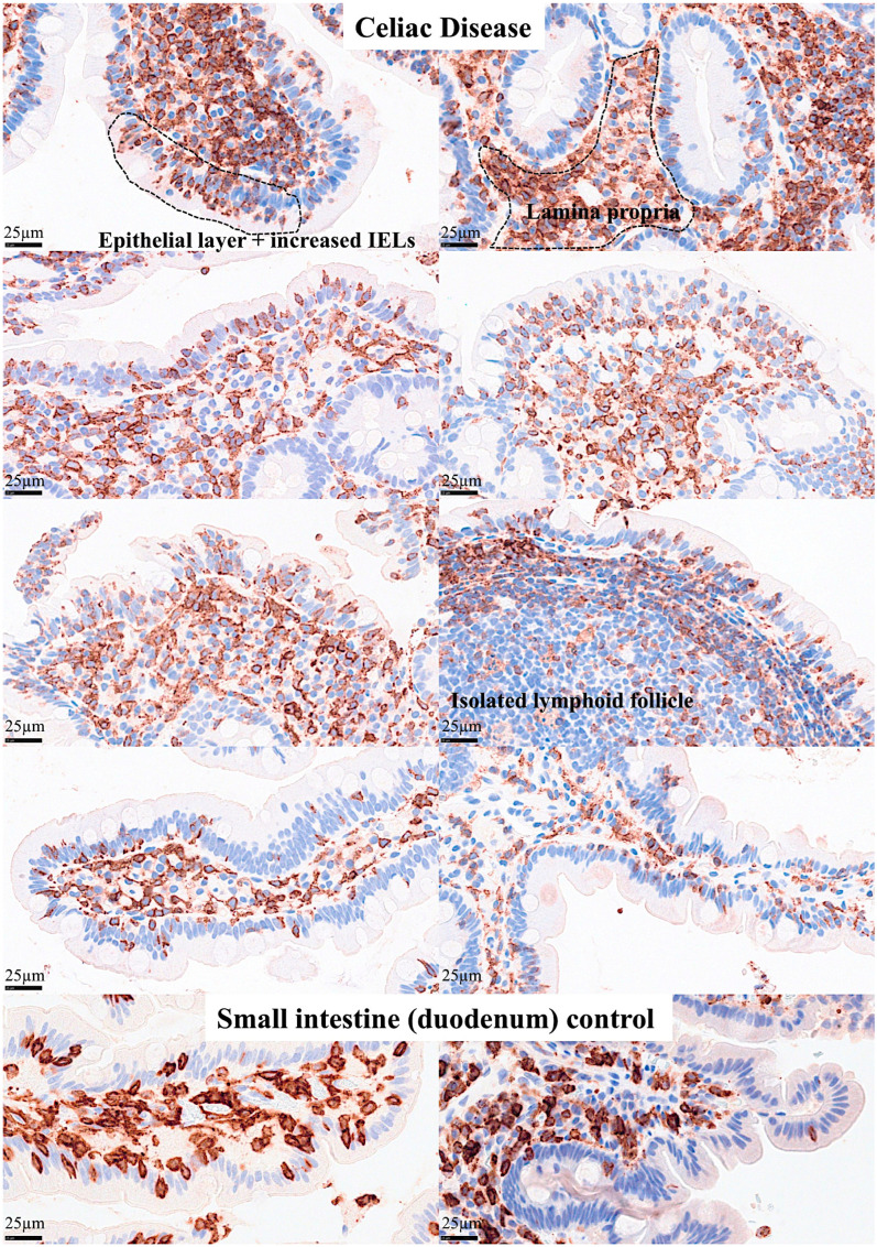 Figure 13