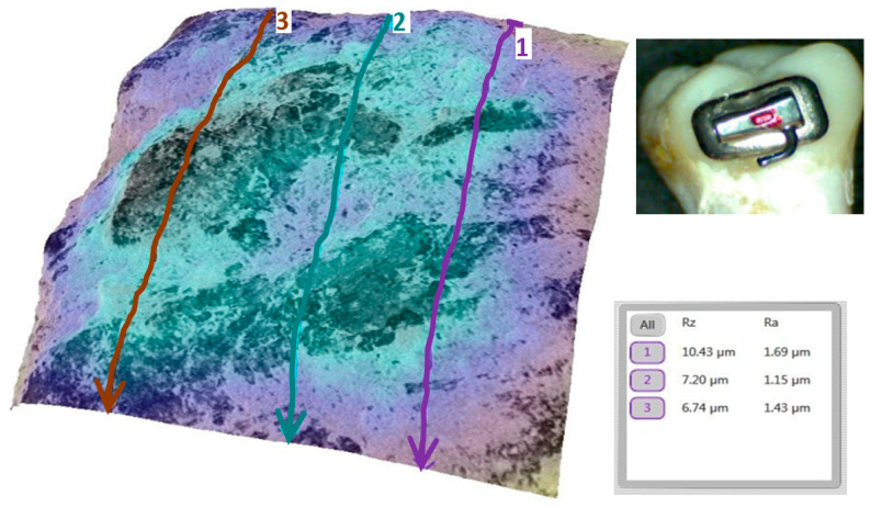 Figure 10