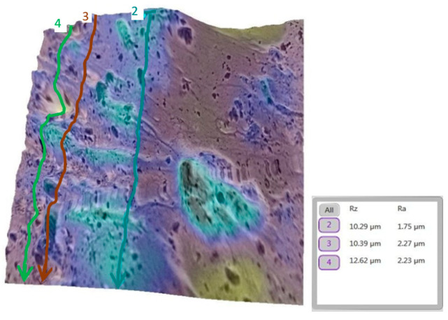 Figure 11