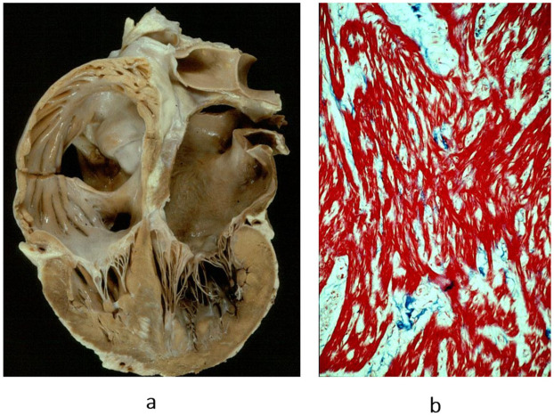 Figure 15