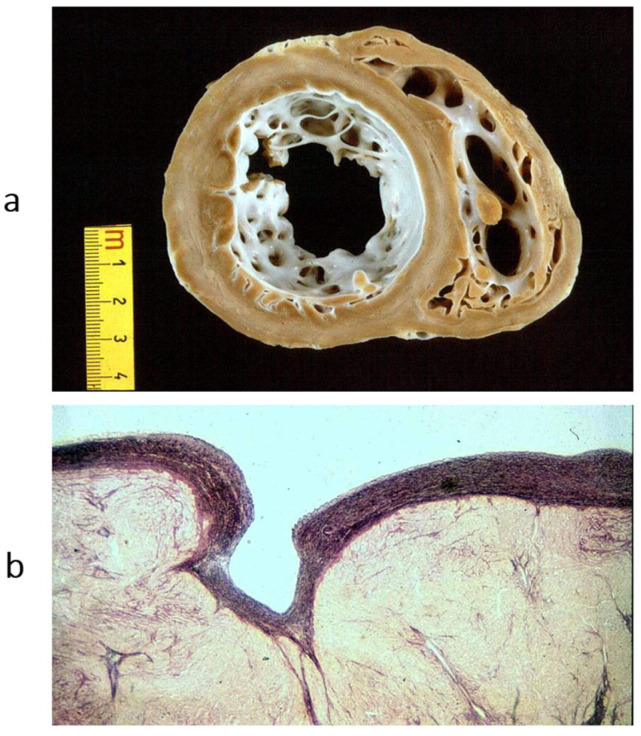 Figure 16