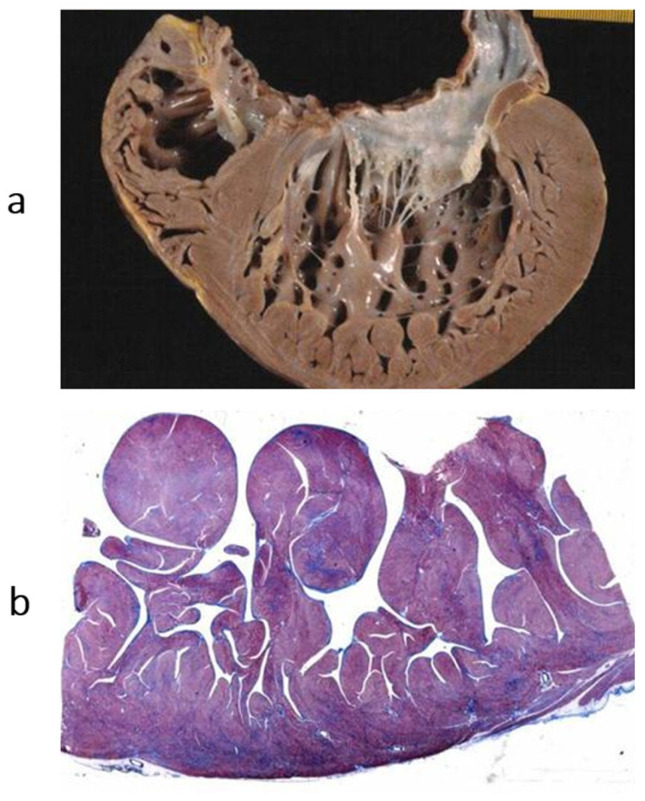 Figure 18