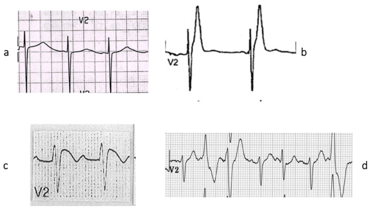 Figure 20