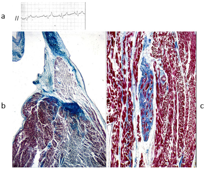 Figure 21