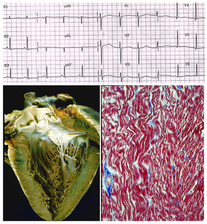 Figure 26