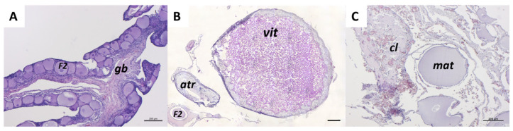 Figure 11