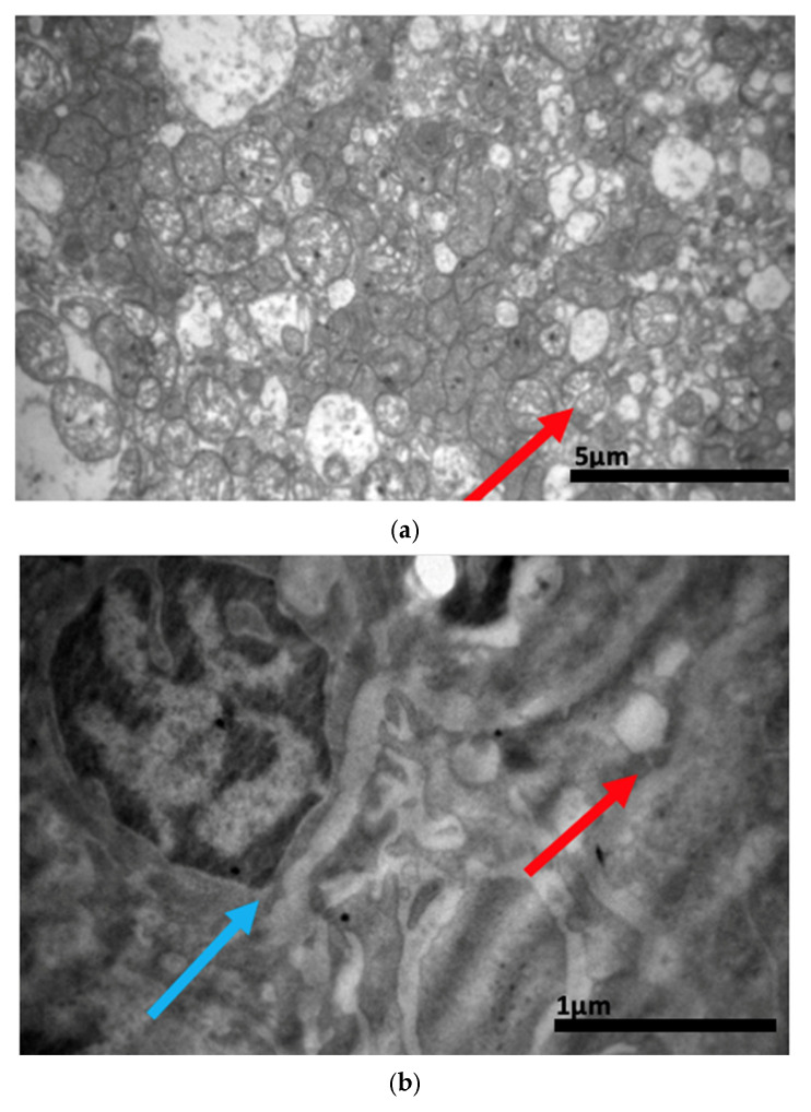 Figure 17