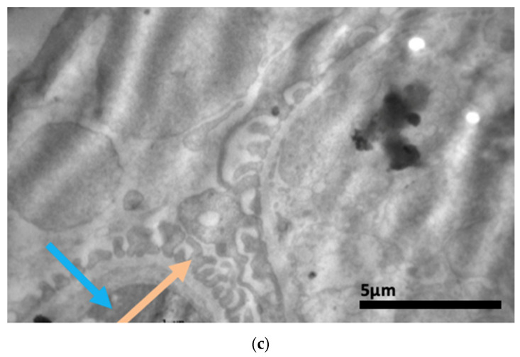 Figure 18