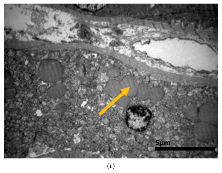 Figure 20