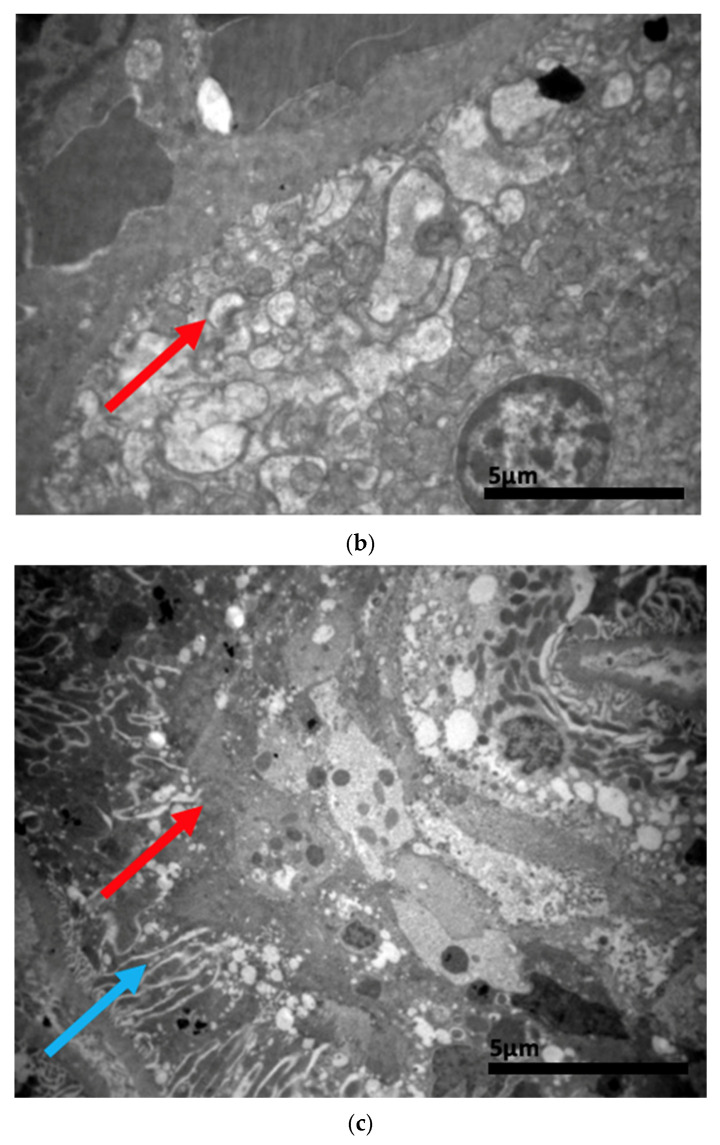 Figure 22
