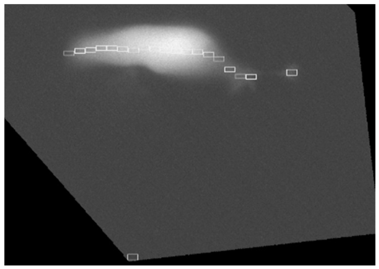 Figure 11