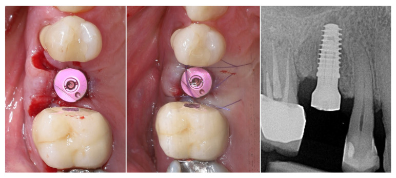 Figure 10