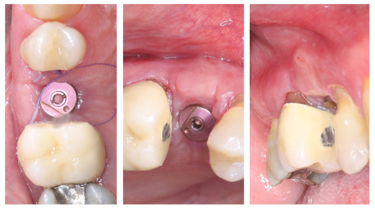 Figure 11