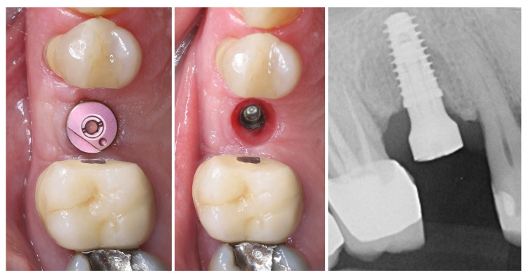 Figure 12