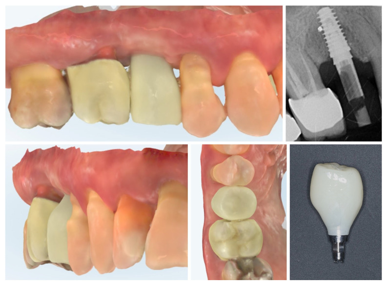 Figure 13