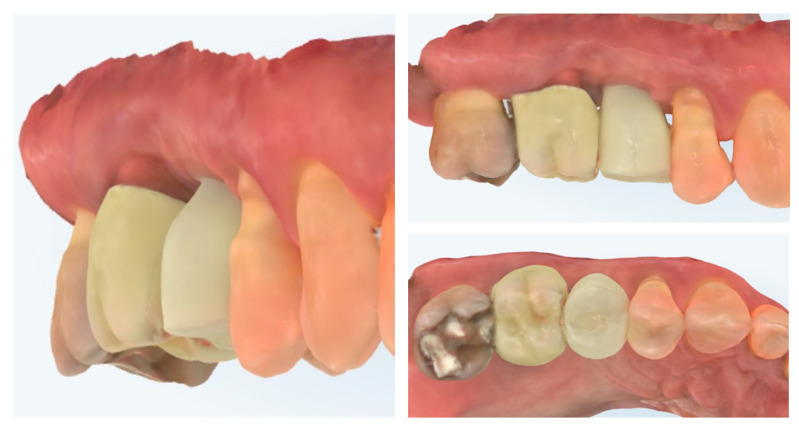 Figure 14