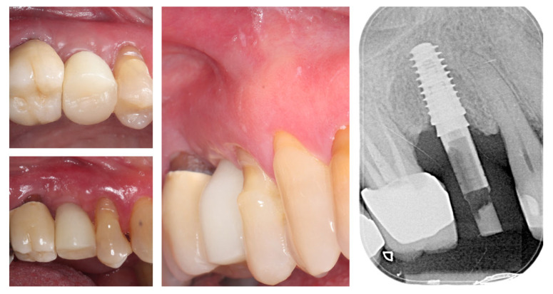 Figure 15
