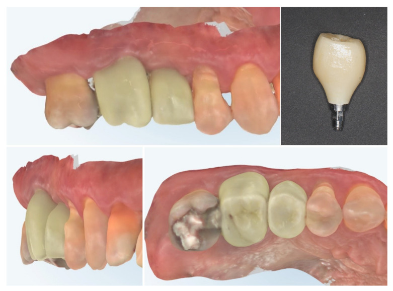 Figure 17