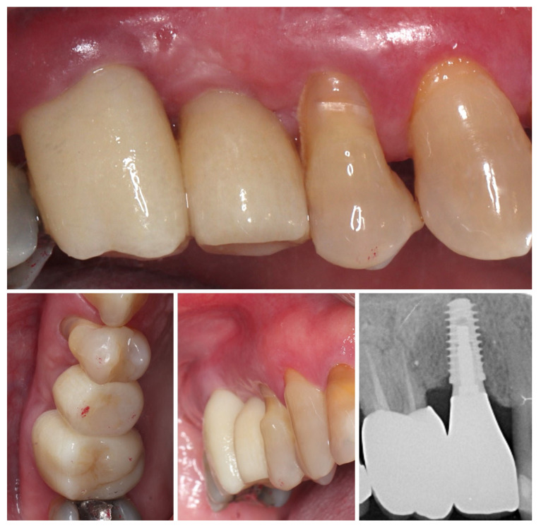 Figure 18