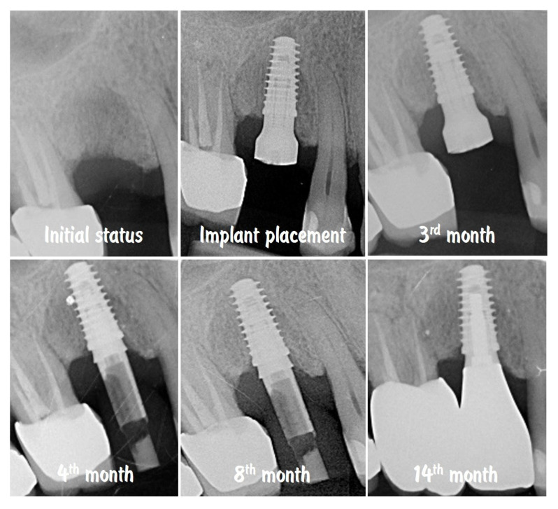 Figure 19
