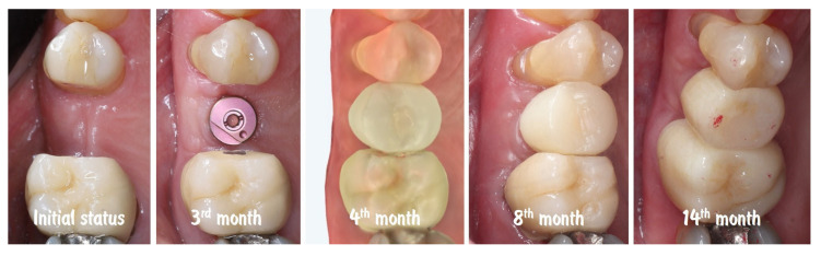 Figure 20