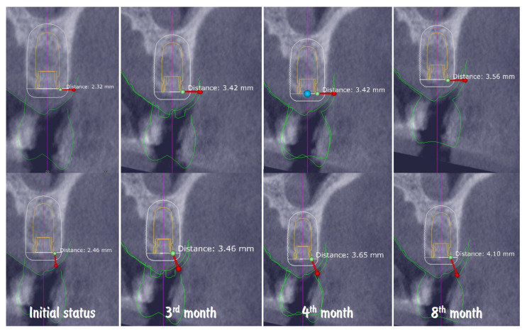 Figure 21