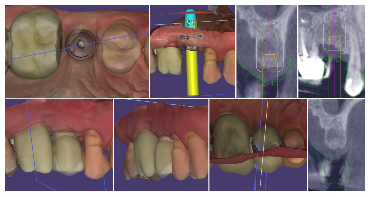 Figure 22