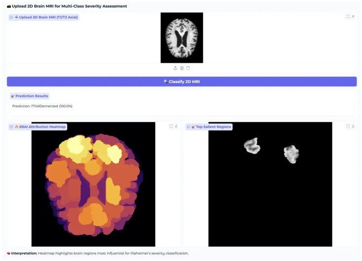 Figure 12