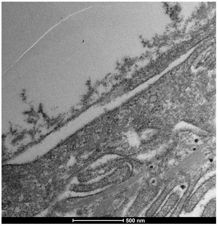 Figure 18