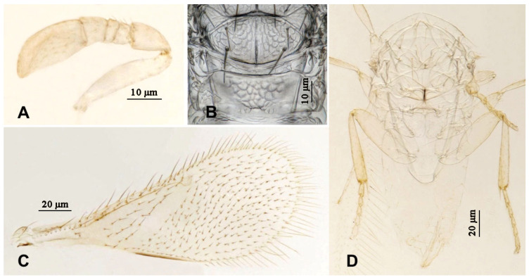 Figure 14