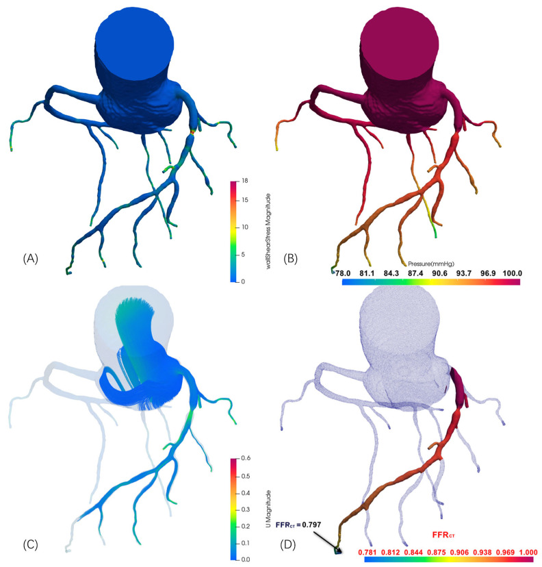 Figure 11