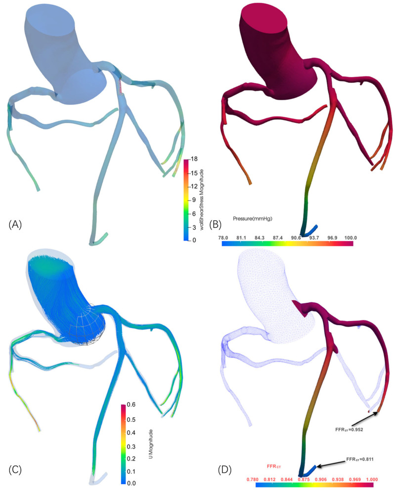 Figure 12