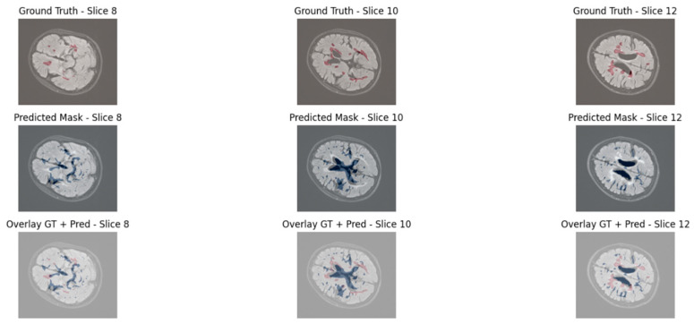 Figure 10