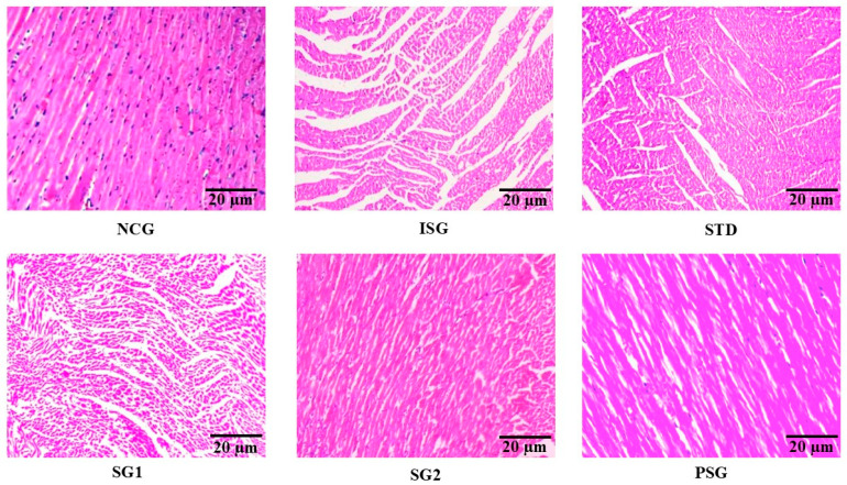 Figure 21