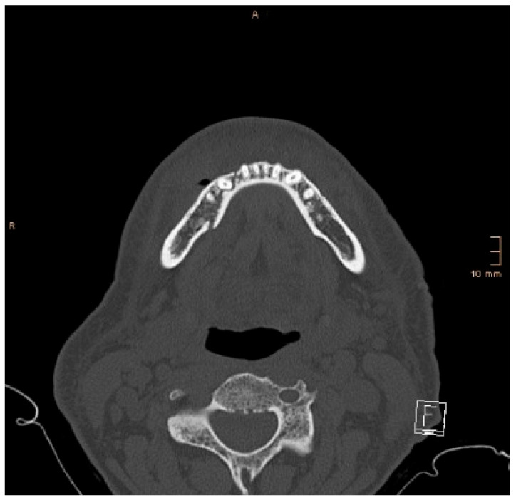 Figure 9