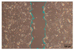 Figure 18