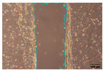 Figure 32