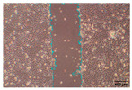 Figure 35