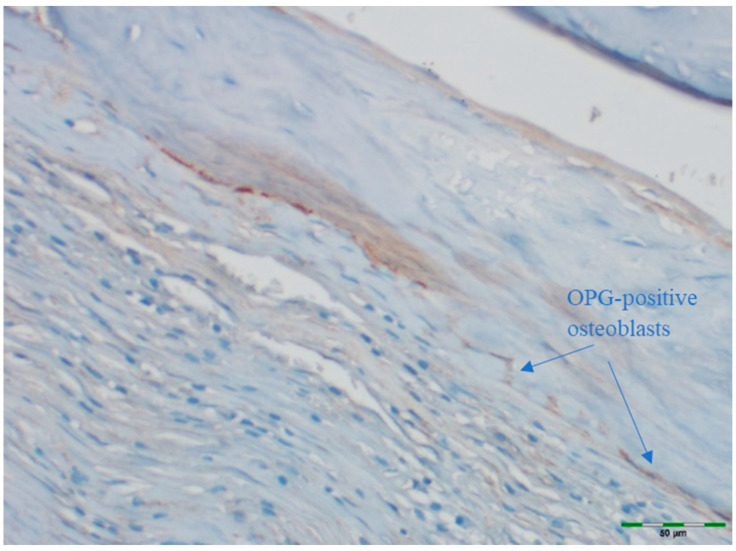 Figure 13