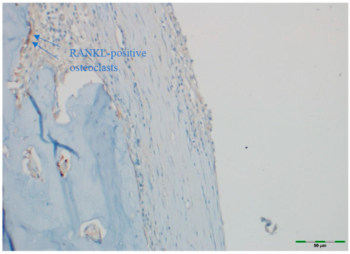 Figure 17