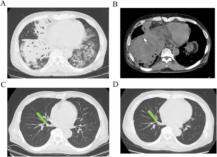 FIGURE 1