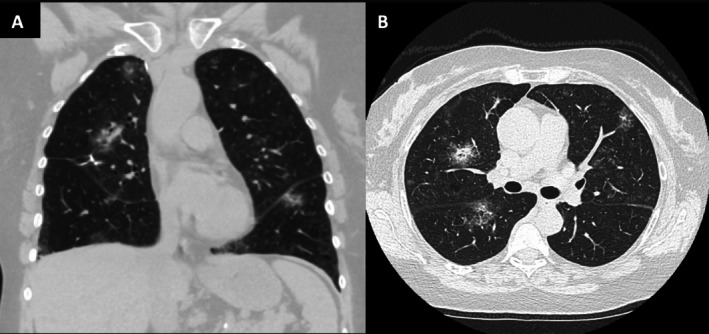 FIGURE 2