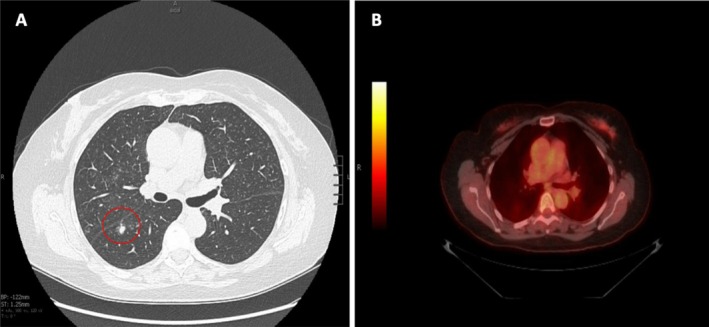 FIGURE 1