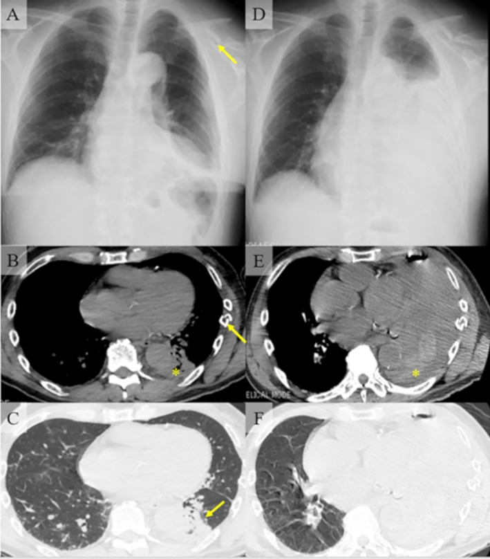 FIGURE 1