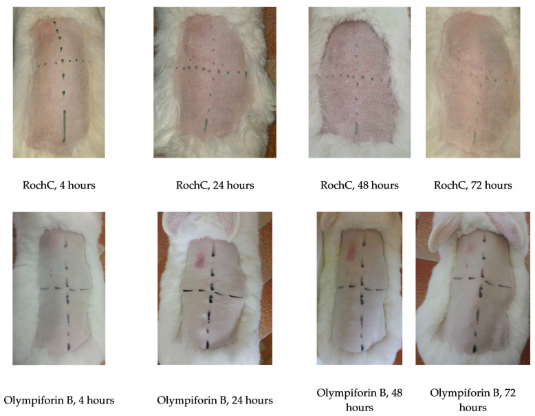 Figure 12