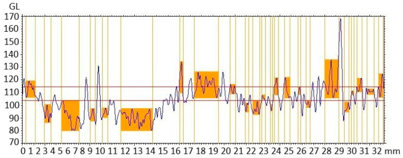 Figure 11
