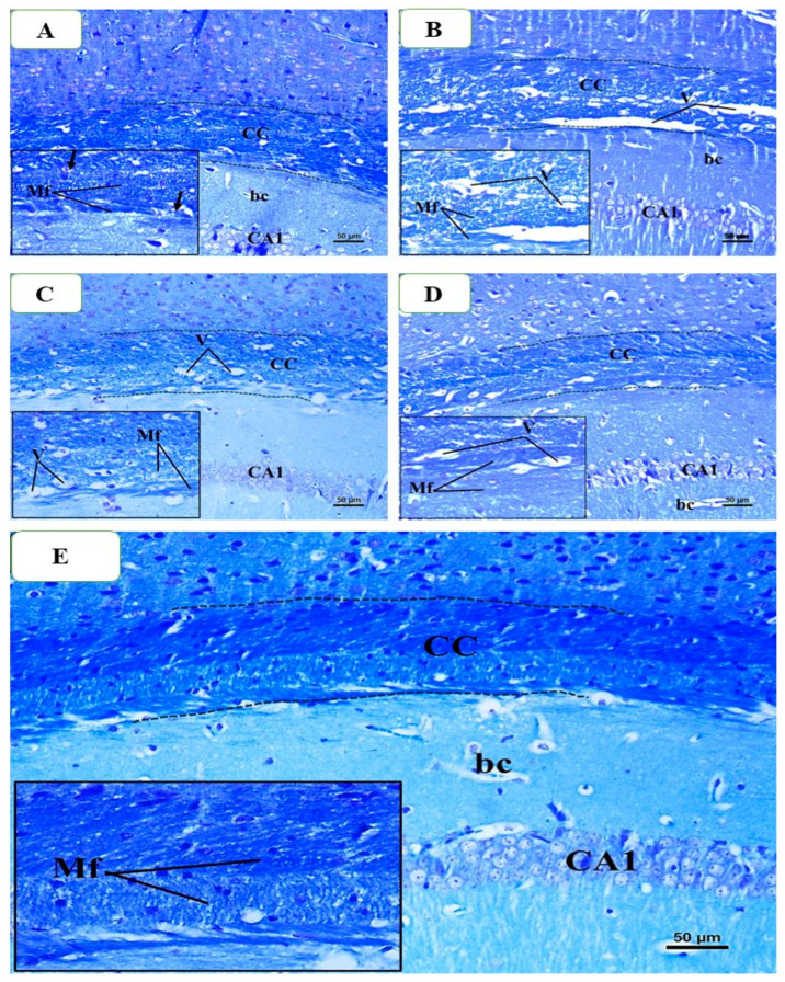 Figure 12