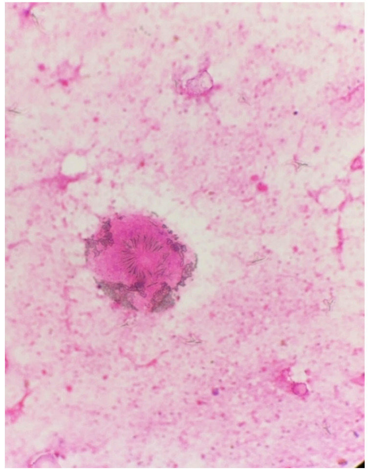 Figure 5