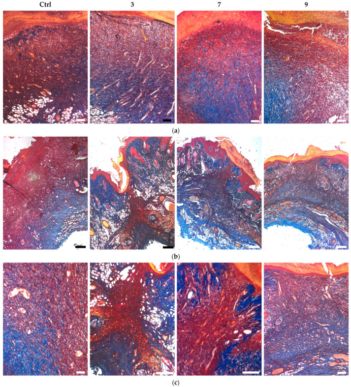 Figure 13